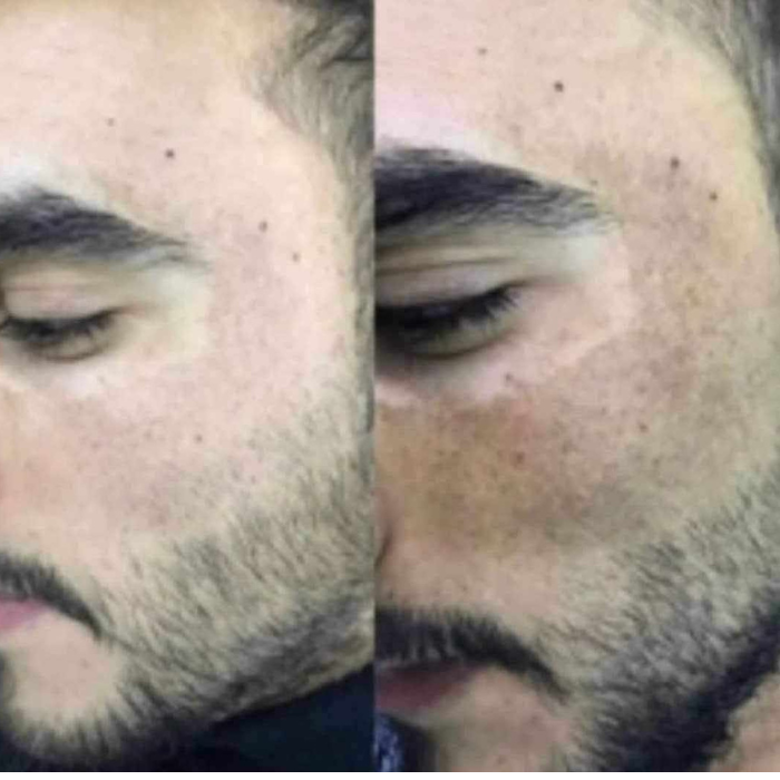 لوشن الصبار بالكولاجين والإيلاستين