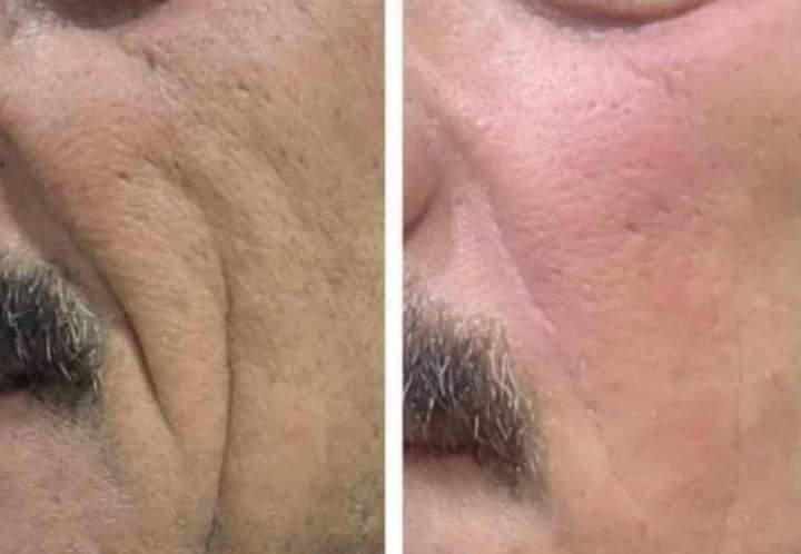 لوشن الصبار بالكولاجين والإيلاستين