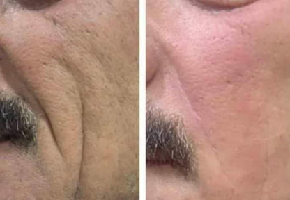 لوشن الصبار بالكولاجين والإيلاستين