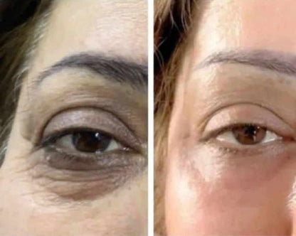 لوشن الصبار بالكولاجين والإيلاستين