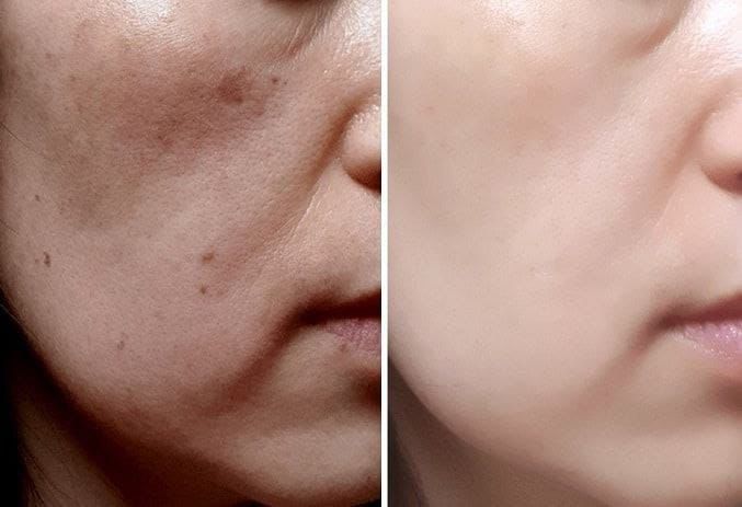 لوشن الصبار بالكولاجين والإيلاستين