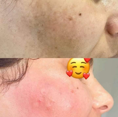 لوشن الصبار بالكولاجين والإيلاستين